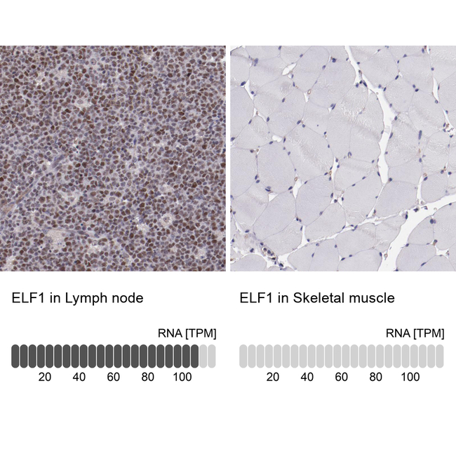 ELF1 Antibody in Immunohistochemistry (Paraffin) (IHC (P))