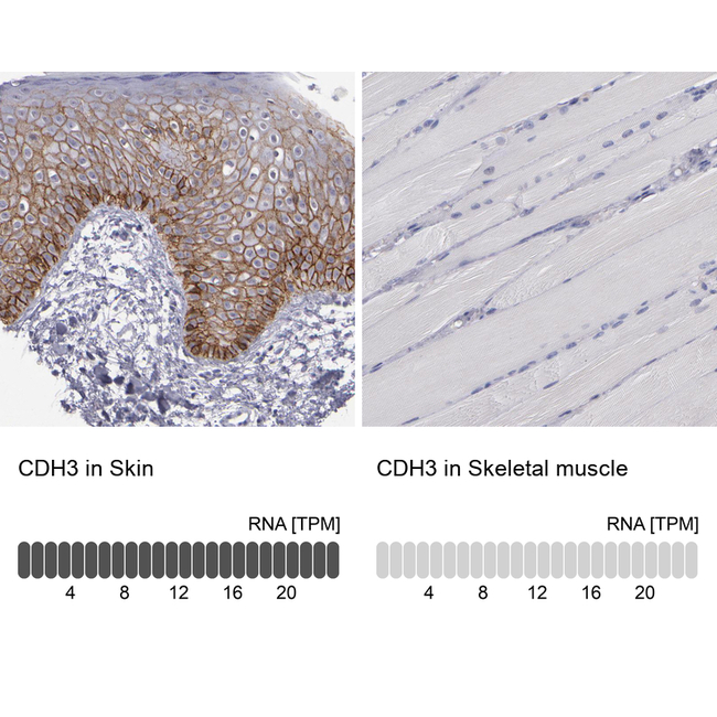 P-cadherin Antibody in Immunohistochemistry (Paraffin) (IHC (P))