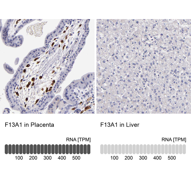 Factor XIII A Antibody in Immunohistochemistry (Paraffin) (IHC (P))