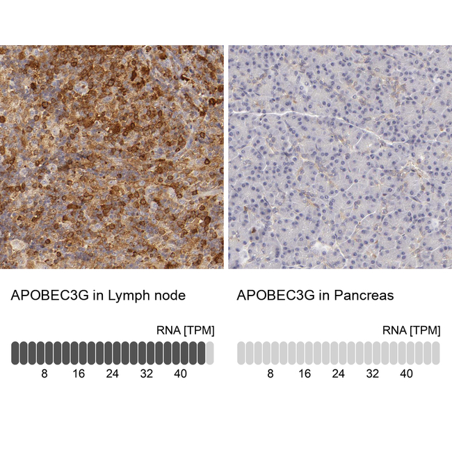 APOBEC3G Antibody in Immunohistochemistry (Paraffin) (IHC (P))