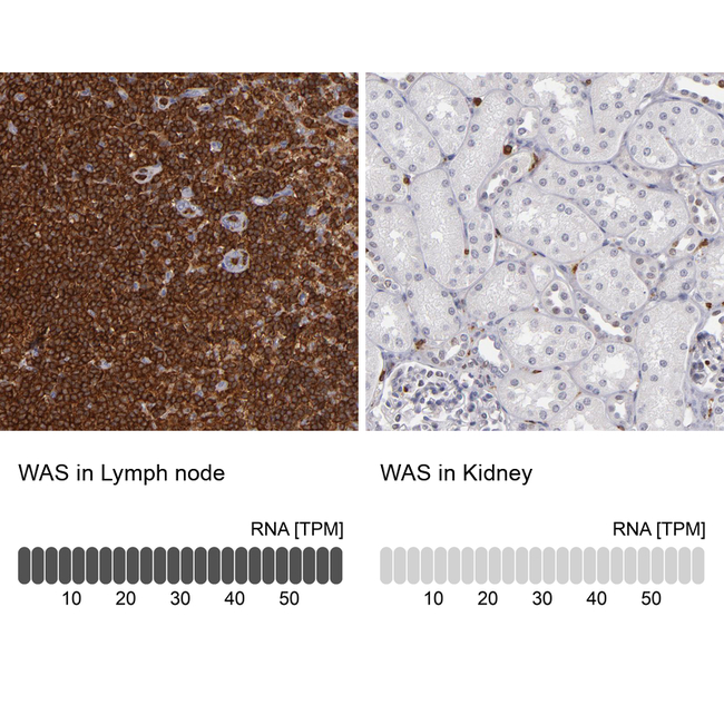 WASP Antibody in Immunohistochemistry (Paraffin) (IHC (P))