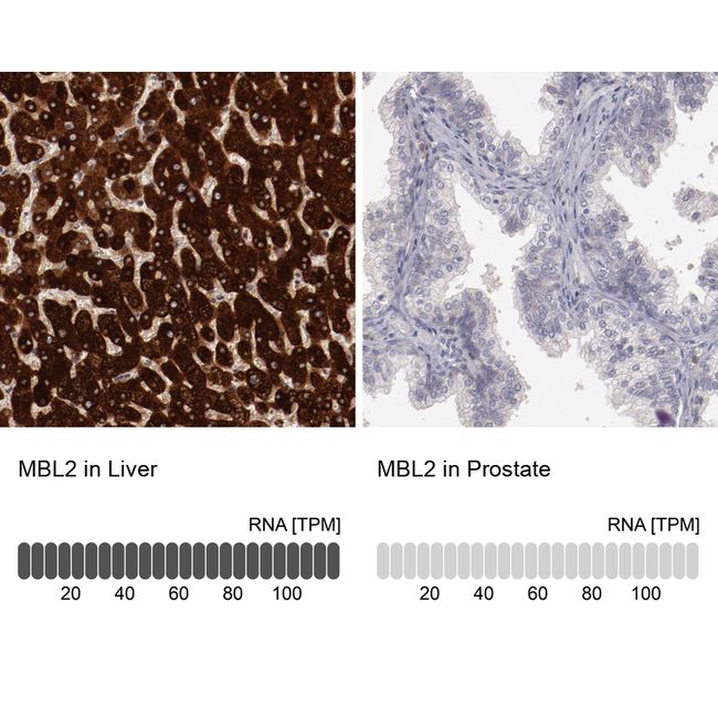 MBL2 Antibody in Immunohistochemistry (Paraffin) (IHC (P))