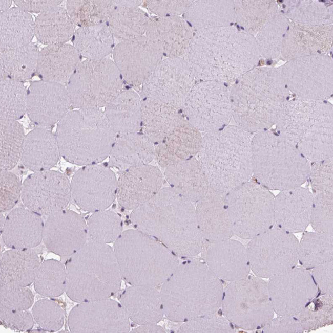 VWF Antibody in Immunohistochemistry (Paraffin) (IHC (P))