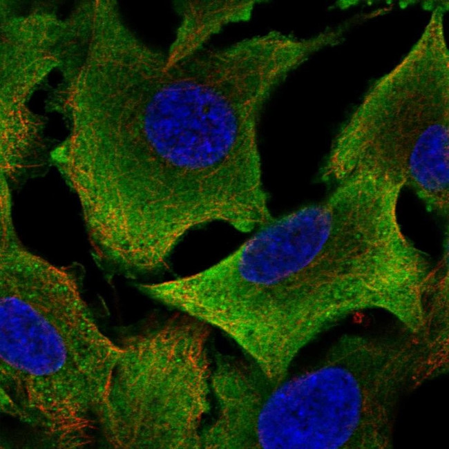 ALDH1A1 Antibody in Immunocytochemistry (ICC/IF)