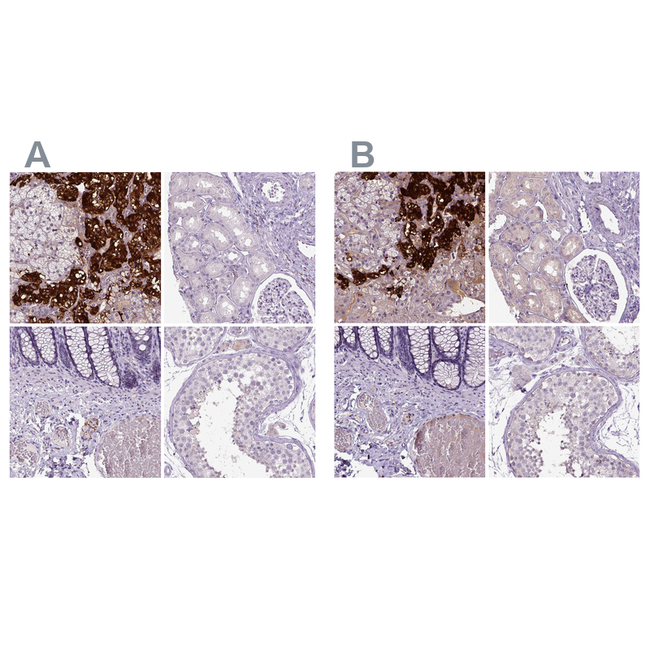 Dopamine beta Hydroxylase Antibody in Immunohistochemistry (Paraffin) (IHC (P))