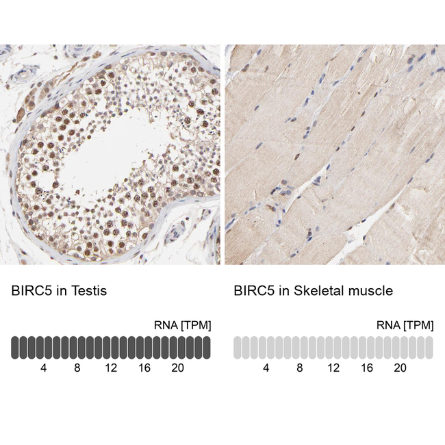 Survivin Antibody in Immunohistochemistry (Paraffin) (IHC (P))