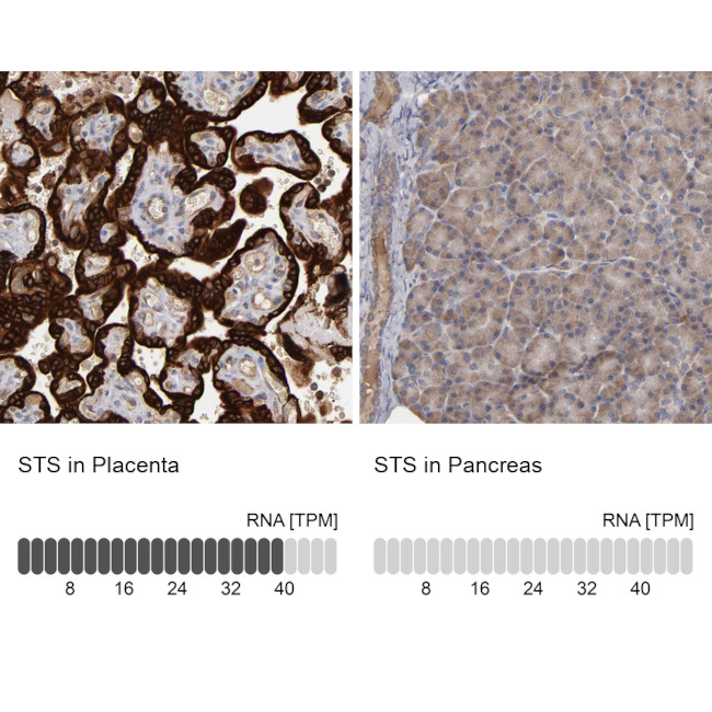 STS Antibody in Immunohistochemistry (Paraffin) (IHC (P))