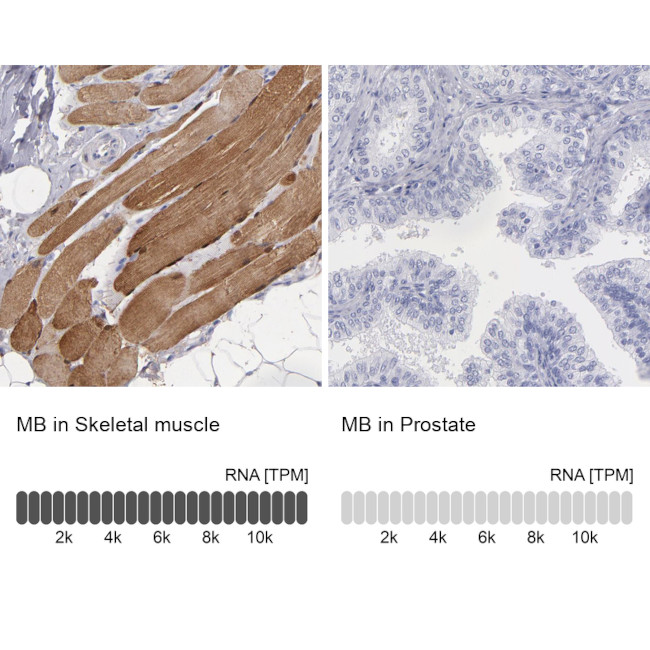 Myoglobin Antibody in Immunohistochemistry (Paraffin) (IHC (P))