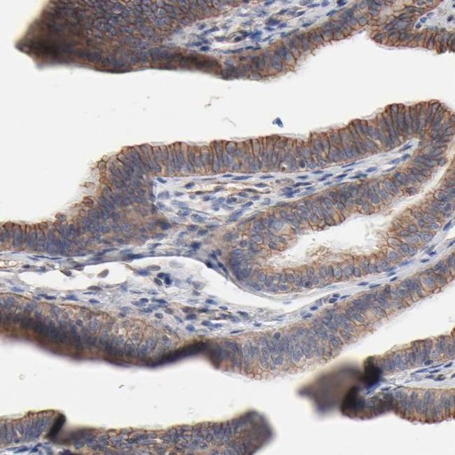 ABCD4 Antibody in Immunohistochemistry (Paraffin) (IHC (P))