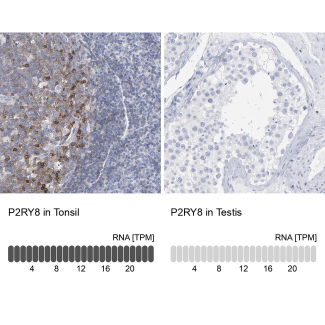 P2Y8 Antibody in Immunohistochemistry (Paraffin) (IHC (P))