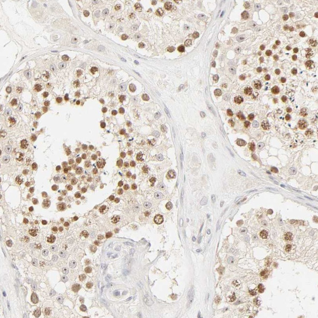 KIF2A Antibody in Immunohistochemistry (Paraffin) (IHC (P))