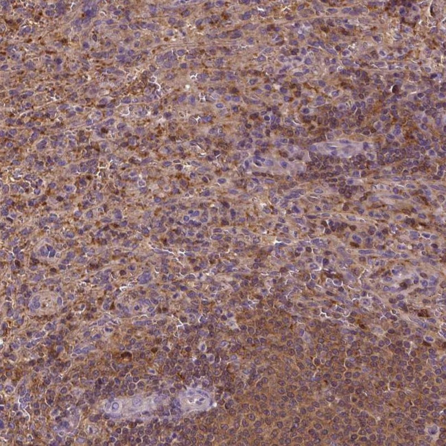 MATK Antibody in Immunohistochemistry (Paraffin) (IHC (P))