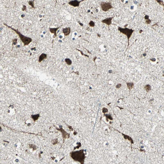AATF Antibody in Immunohistochemistry (Paraffin) (IHC (P))