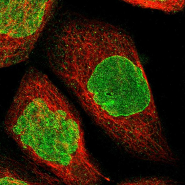 BRIP1 Antibody in Immunocytochemistry (ICC/IF)