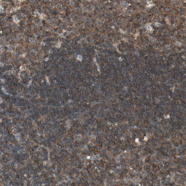 TEC Antibody in Immunohistochemistry (Paraffin) (IHC (P))