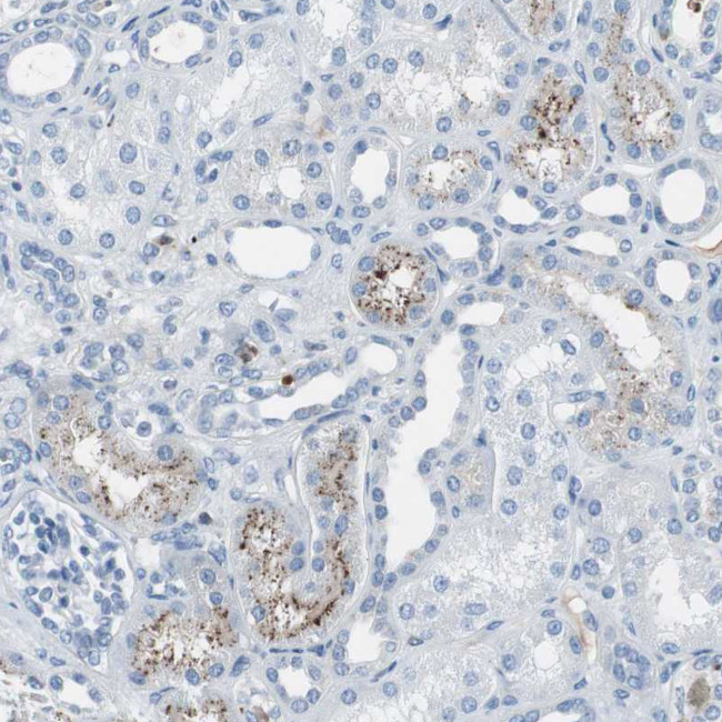 PEDF Antibody in Immunohistochemistry (Paraffin) (IHC (P))