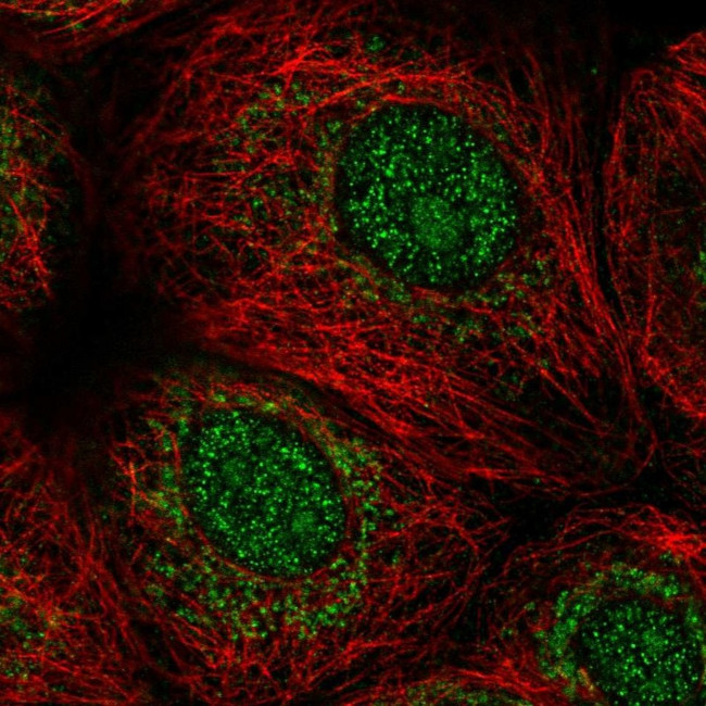 MORN1 Antibody in Immunocytochemistry (ICC/IF)