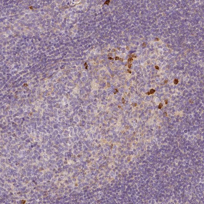 CD148 Antibody in Immunohistochemistry (Paraffin) (IHC (P))