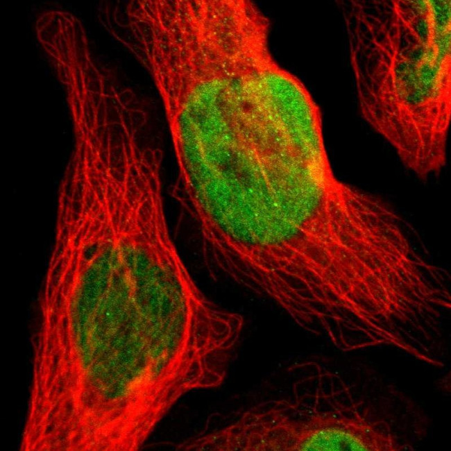 GATAD1 Antibody in Immunocytochemistry (ICC/IF)