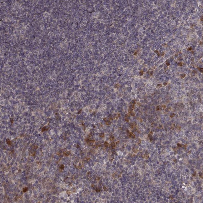 USP15 Antibody in Immunohistochemistry (Paraffin) (IHC (P))