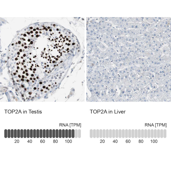 TOP2A Antibody in Immunohistochemistry (Paraffin) (IHC (P))