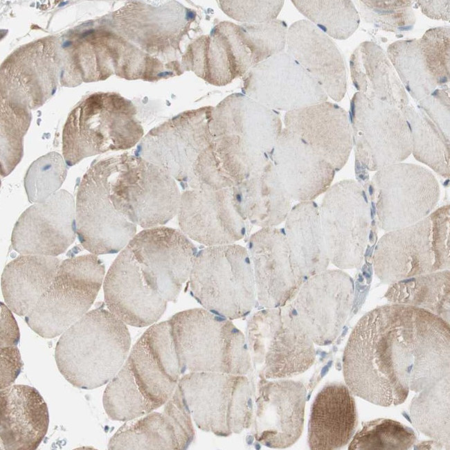 NCLN Antibody in Immunohistochemistry (Paraffin) (IHC (P))