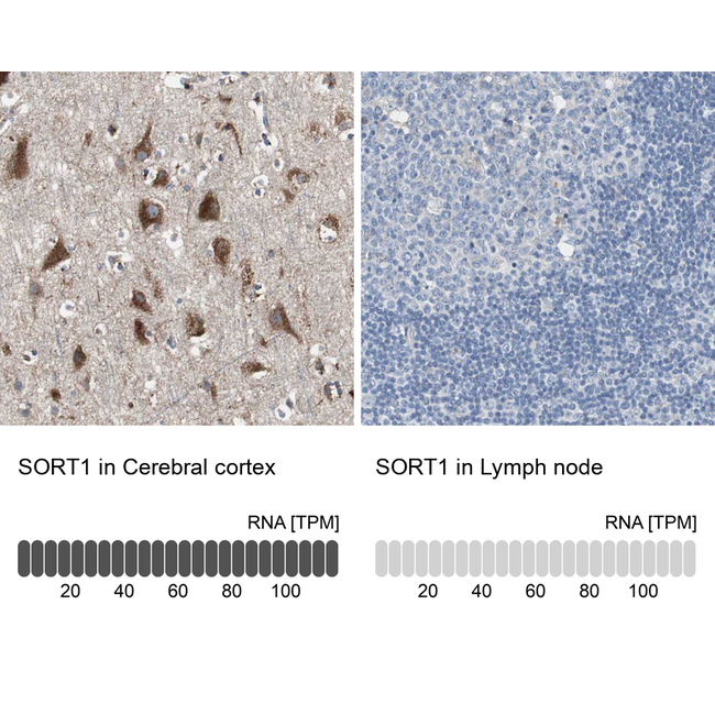 Sortilin Antibody in Immunohistochemistry (Paraffin) (IHC (P))
