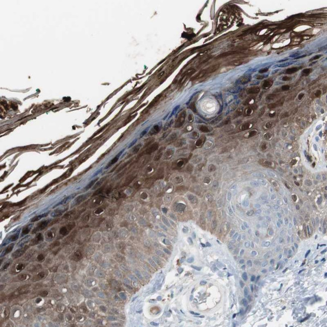 S100A7 Antibody in Immunohistochemistry (Paraffin) (IHC (P))