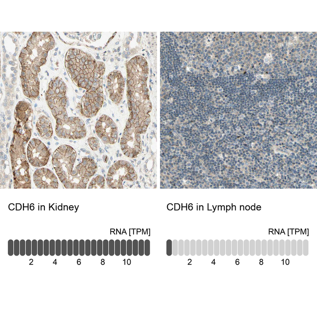 K-cadherin Antibody in Immunohistochemistry (Paraffin) (IHC (P))