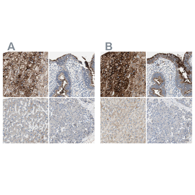 ALPL Antibody in Immunohistochemistry (Paraffin) (IHC (P))