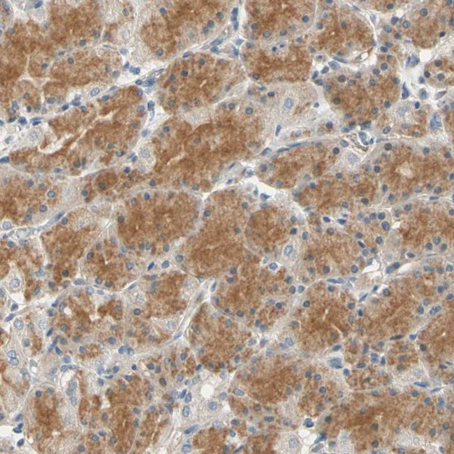 GPR153 Antibody in Immunohistochemistry (Paraffin) (IHC (P))
