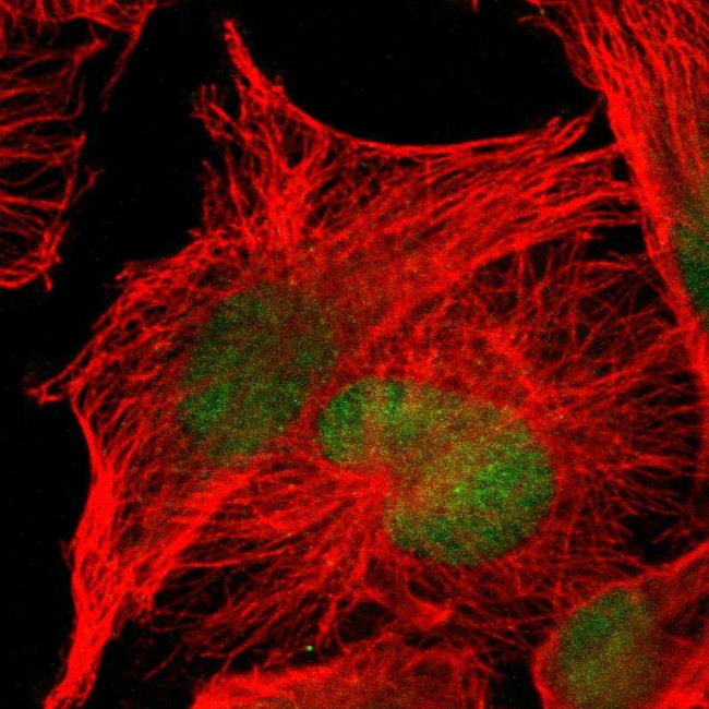 CAMK1D Antibody in Immunocytochemistry (ICC/IF)
