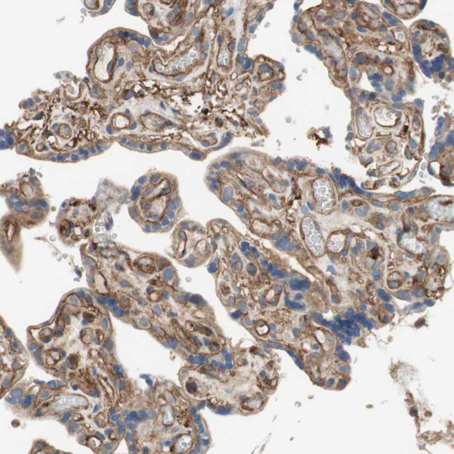 ST2 Antibody in Immunohistochemistry (Paraffin) (IHC (P))