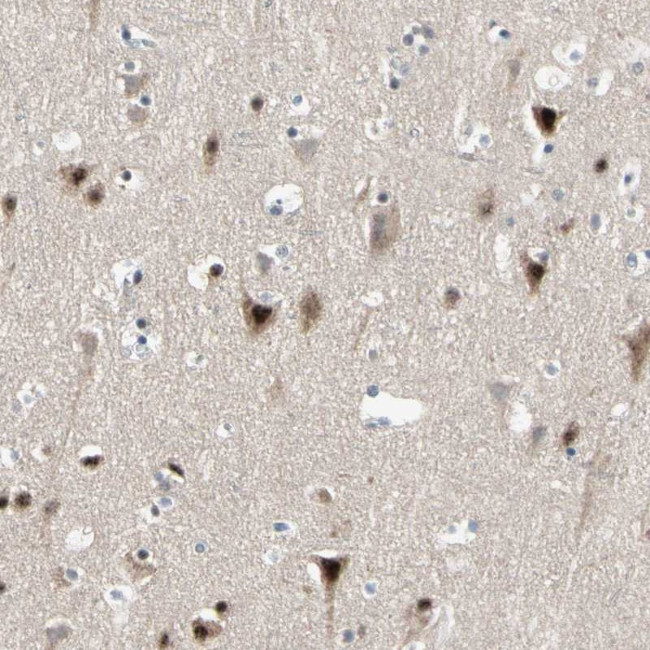 MARK1 Antibody in Immunohistochemistry (Paraffin) (IHC (P))