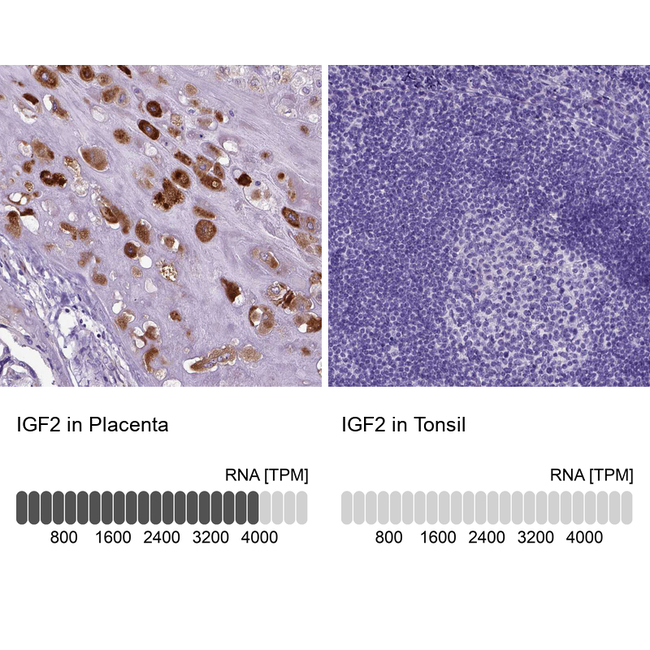 IGF2 Antibody in Immunohistochemistry (Paraffin) (IHC (P))
