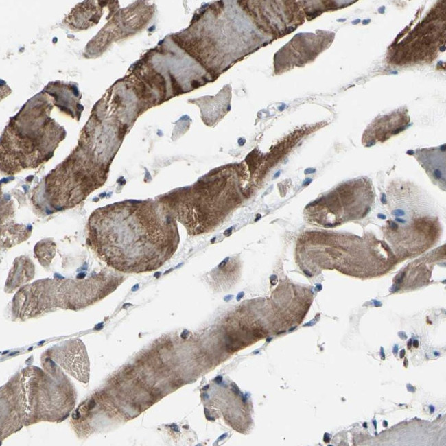 HIPK2 Antibody in Immunohistochemistry (Paraffin) (IHC (P))