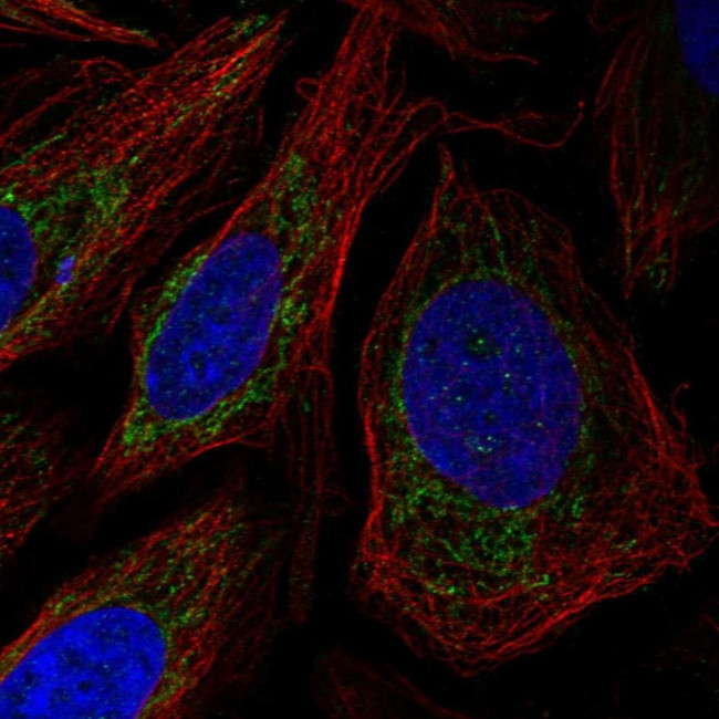 POLDIP2 Antibody in Immunocytochemistry (ICC/IF)