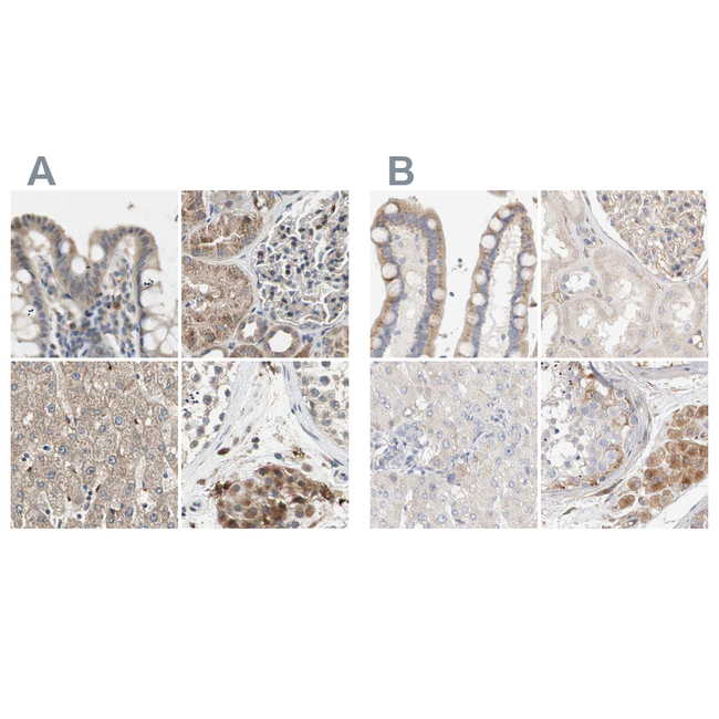 Protein S Antibody in Immunohistochemistry (Paraffin) (IHC (P))