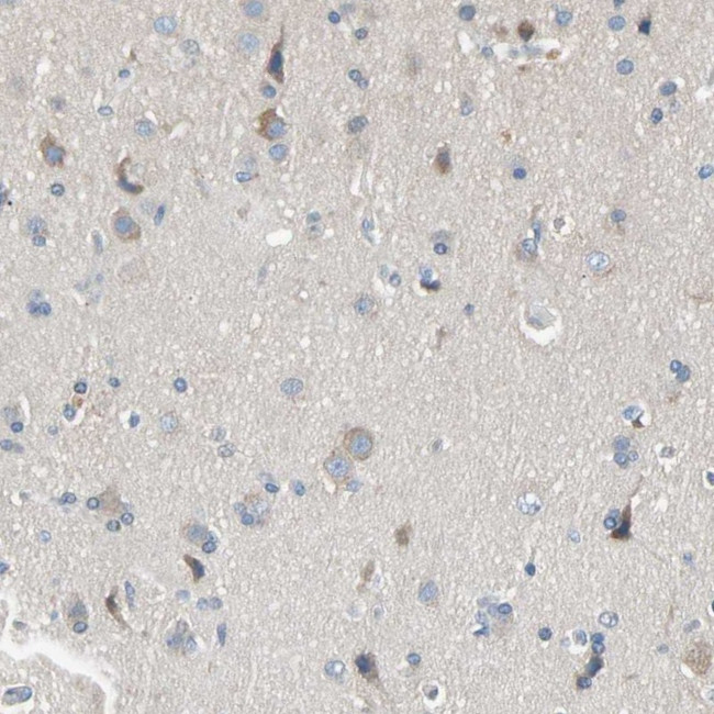 MARK1 Antibody in Immunohistochemistry (Paraffin) (IHC (P))