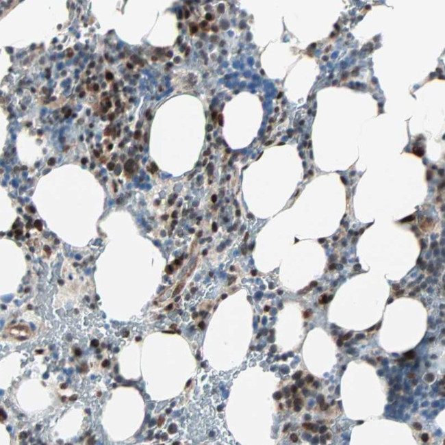 CBX4 Antibody in Immunohistochemistry (Paraffin) (IHC (P))