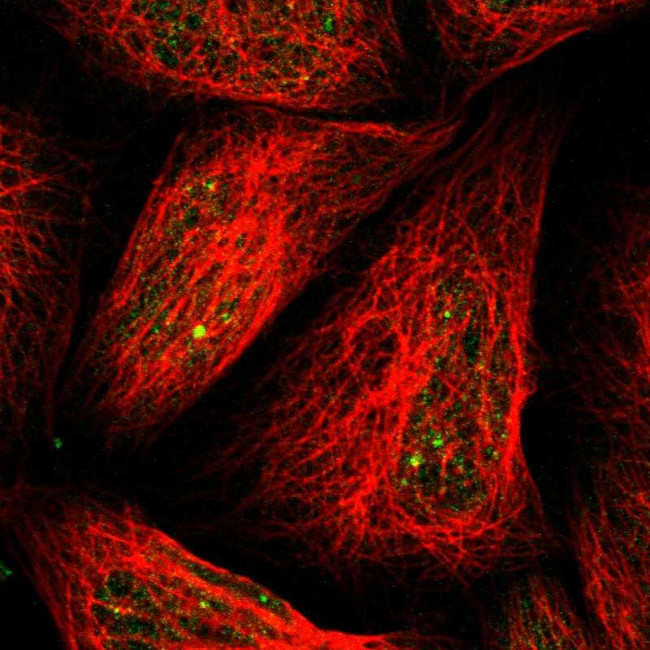 MUTYH Antibody in Immunocytochemistry (ICC/IF)