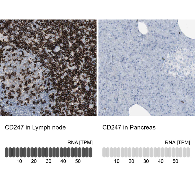 CD3z Antibody in Immunohistochemistry (Paraffin) (IHC (P))