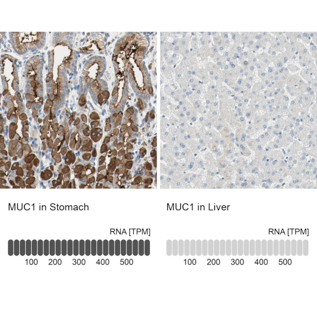 MUC1 Antibody in Immunohistochemistry (Paraffin) (IHC (P))