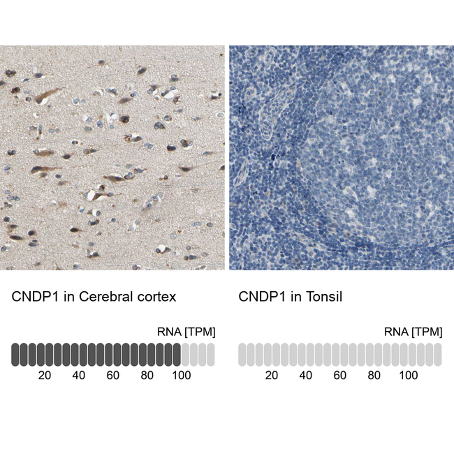 CNDP1 Antibody in Immunohistochemistry (Paraffin) (IHC (P))