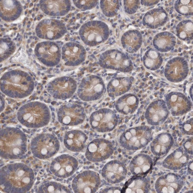 CEP104 Antibody in Immunohistochemistry (Paraffin) (IHC (P))