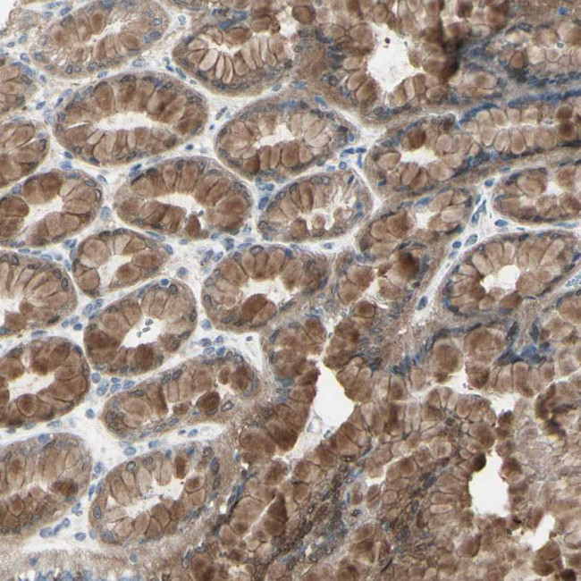 ETNK1 Antibody in Immunohistochemistry (Paraffin) (IHC (P))