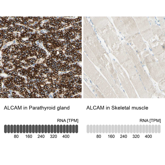 CD166 Antibody in Immunohistochemistry (Paraffin) (IHC (P))