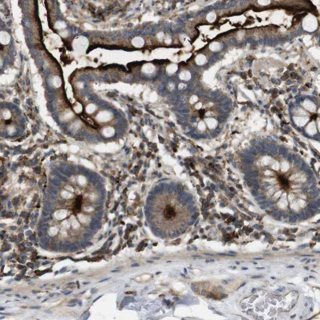 KSR1 Antibody in Immunohistochemistry (Paraffin) (IHC (P))