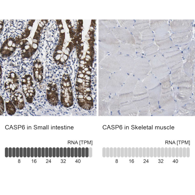 Caspase 6 Antibody in Immunohistochemistry (Paraffin) (IHC (P))