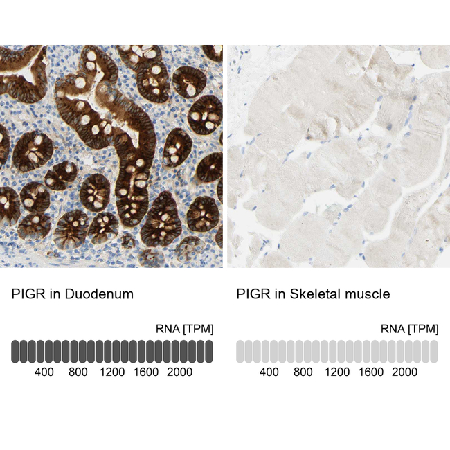 PIGR Antibody in Immunohistochemistry (Paraffin) (IHC (P))